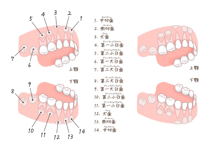 八重歯と犬歯は違う？八重歯とは